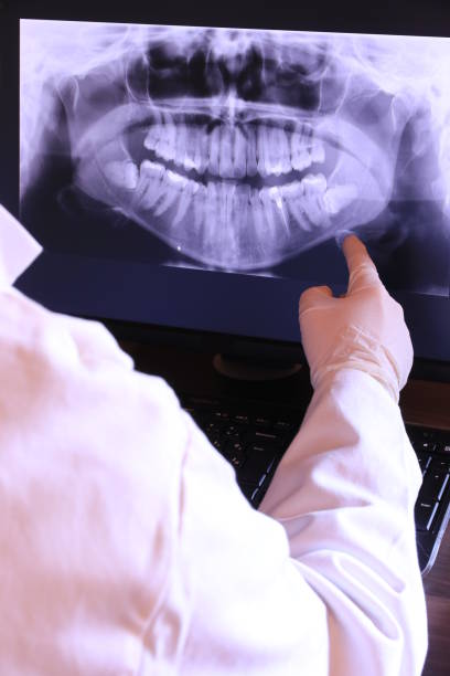 Best Emergency Tooth Extraction in Shannon, MS